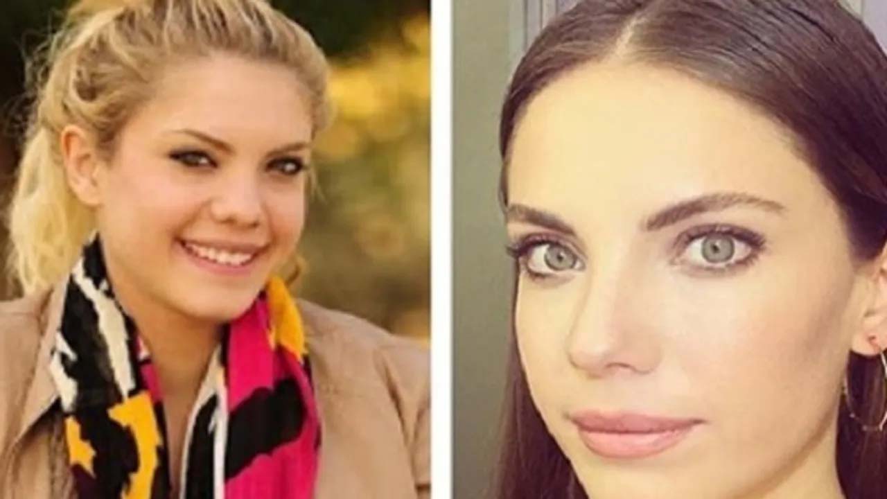 Yasak Elma’nın Yıldız’ı Resmen Esmerleri Utandırdı! Yıllar Önceki Hali Şoke Etti!