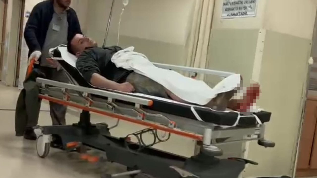 Sokaktaki Tartışmada Bacağından Vuruldu