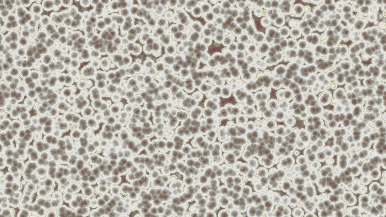 Bu belirtiler varsa, bir doktora başvurun! O tehlikeli hastalık sizi ele geçiriyor olabilir