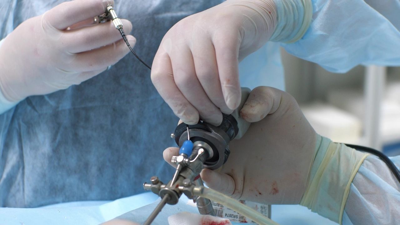 Endoskopi - kolonoskopi orucu bozar mı? Kaza gerekir mi?